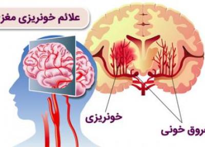 علائم خونریزی مغزی چیست؟